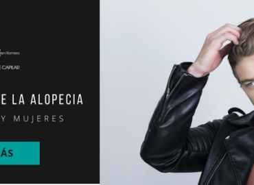 Alopecia
