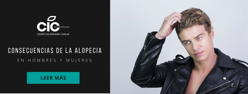 Alopecia