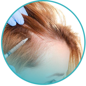 //cicecuador.com/wp-content/uploads/2019/04/mesoterapia-300x300.png